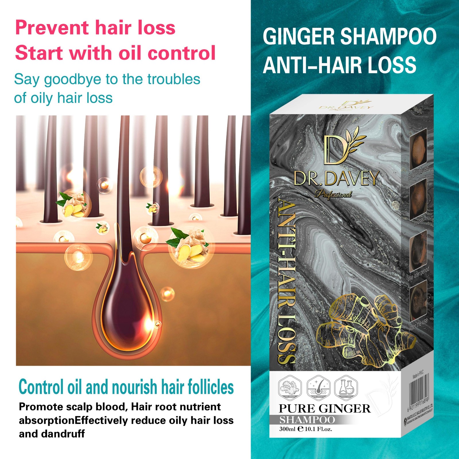 Anti-hair loss Ginger Shampoo